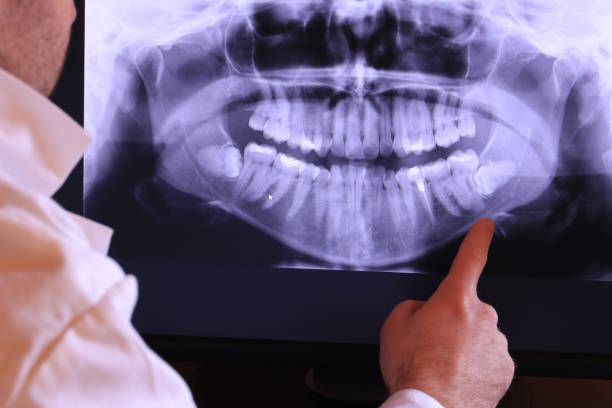 Best Emergency Dental Services for Seniors in Ship Bottom, NJ
