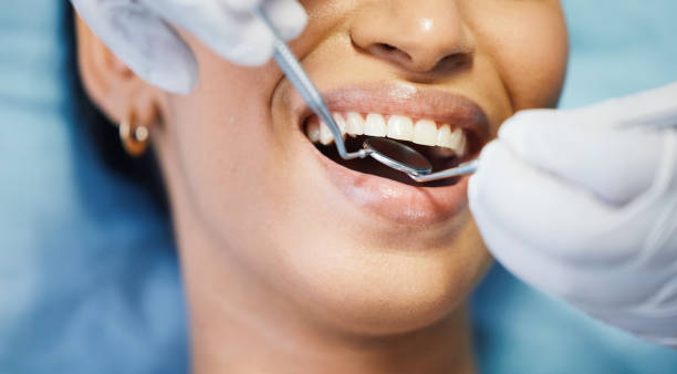 Best Emergency Dentist for Lost Fillings or Crowns in Ship Bottom, NJ
